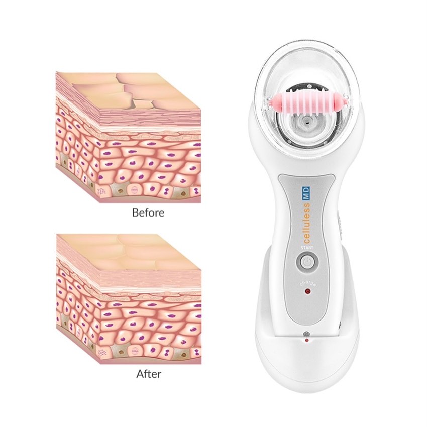 Celluless® - Máquina de Reducción de Celulitis