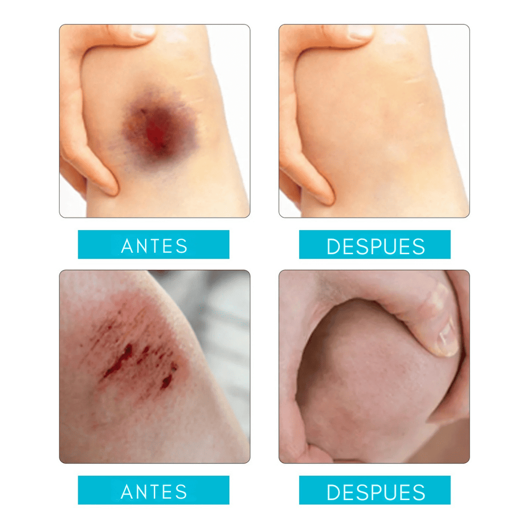 JAYSUING® - Gel Spray Sellador de Heridas 30ml